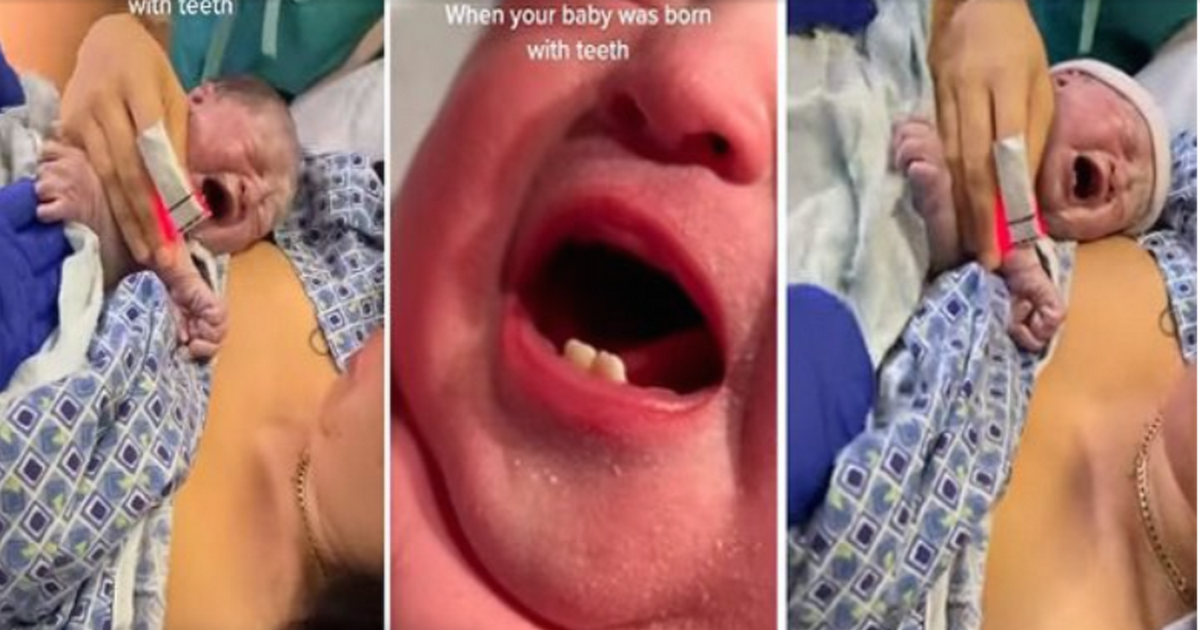 bebe, nait, deux, dents